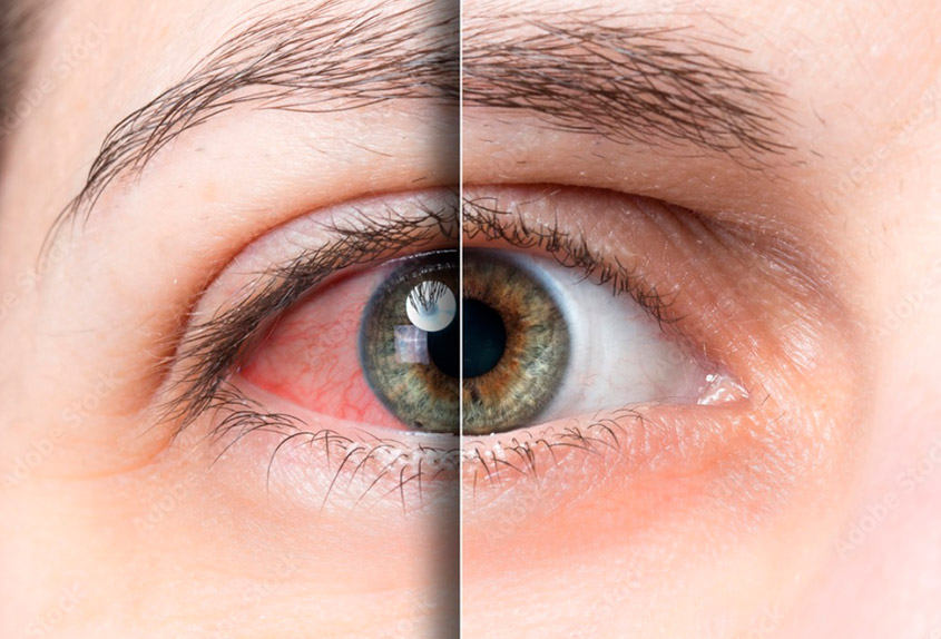 spa ojos